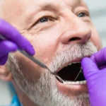 Recovering From Dental Implants Tips For A Smooth Healing Process