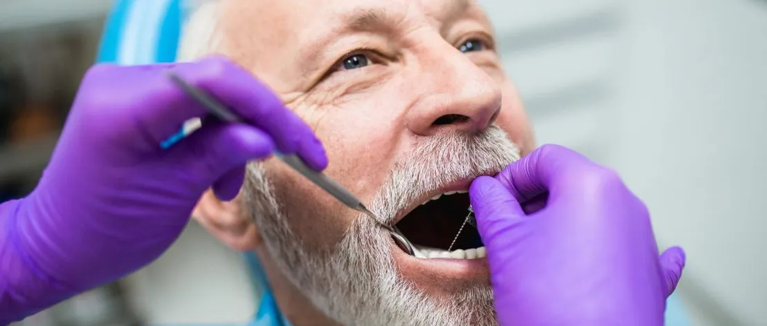 Recovering From Dental Implants Tips For A Smooth Healing Process